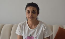GÜNCELLEME - Kırklareli'nde bir kadın, düğündeki kavgada tüfekten çıkan saçmalarla gözünden yaralandı